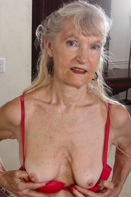 old women stretch marks